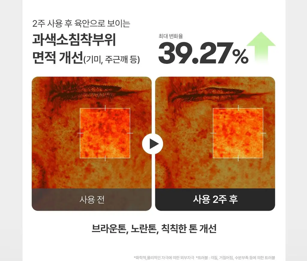 [1등모공에센스] VT 리들샷 100 에센스 30ml 더블 기획(+피디알엔 에센스 100 1.5ml*3ea) 상세페이지 27